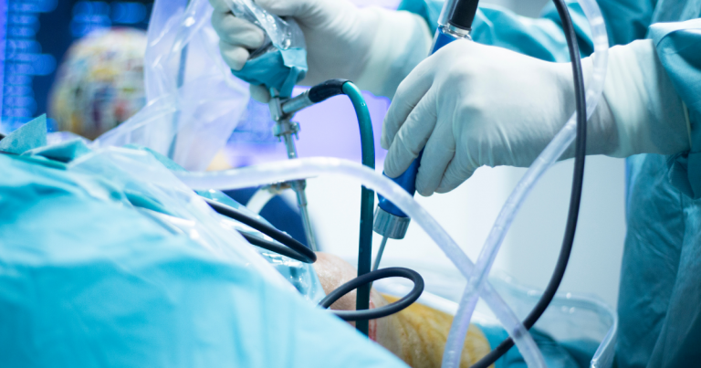 ארטרוסקופיה כתף