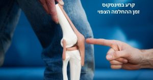 קרע במיניסקוס - זמן החלמה